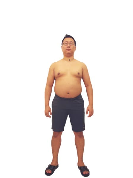 광주점 장혁 원장님 Before